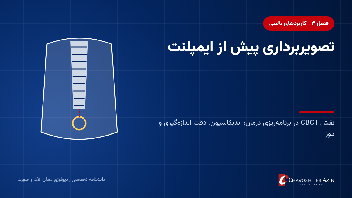 CBCT برای ایمپلنت: نقش تصویربرداری پیش از ایمپلنت در برنامه‌ریزی درمان